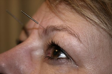 Normalt syn hos patient